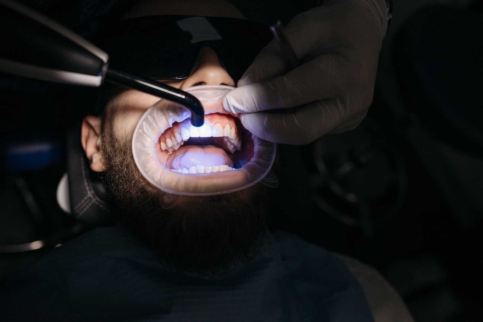 Laser and light-based dental treatment